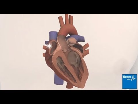 Common types of heart arrhythmias