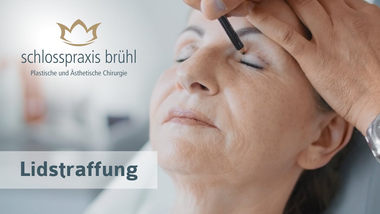 Achmed Tobias Scheersoi-12