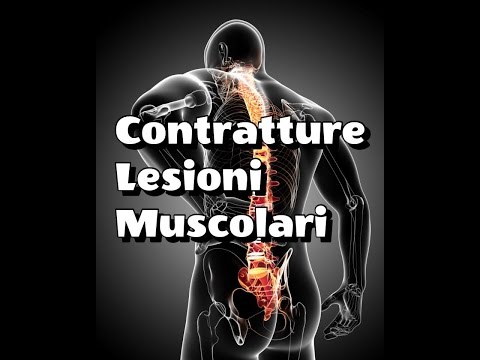 Dolore intorno il trattamento della colonna vertebrale Se da una mancanza di calcio coi articolazioni