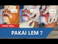 Pria Ini Cukur Kumis Tapi Pakai Lem