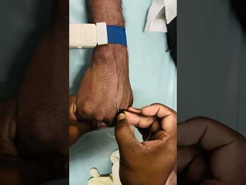 Scalp Vein Set Insertion technique | S V Set Insertion | I V Injection #injection #reels #iv #shorts