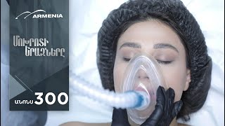 Մոխրոտի Երազները, Սերիա 300, Անոնս / Mokhroti Eraznery