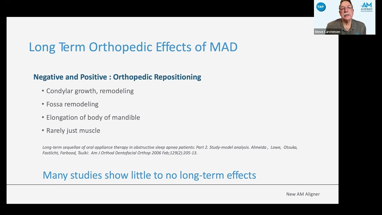 New AM Aligner: Effects of MAD