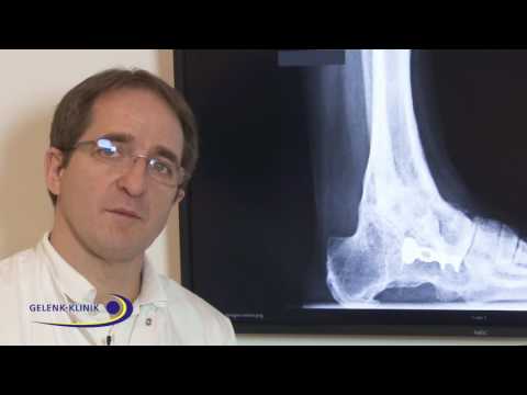 Liegend stark wunden Rücken Bewegungstherapie in Osteochondrose der Lendenwirbelsäule sacrum