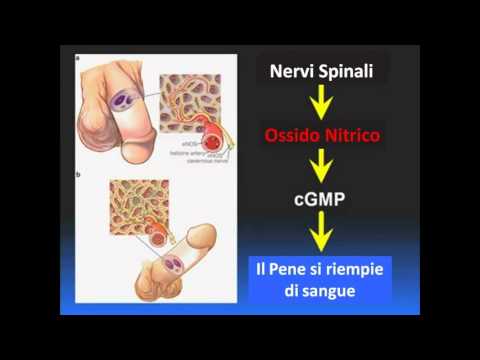 Aumento del pene Diminuendo così la potenza