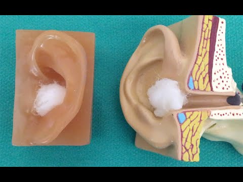 YouTube video about: Can I put cotton balls in my dog's ears?