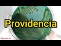 providencia stuartiil/alcalifaciens/rettgeri sur gélose hectoen
