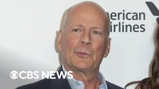Bruce Willis diagnosed with aphasia, stepping away from acting