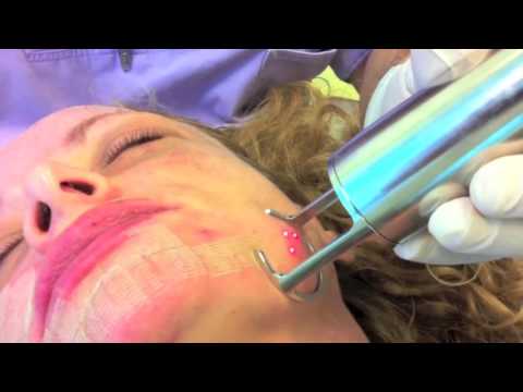 Ginnastica per la persona da rughe video Margarita Levchenko di video Crema di Chanel sollevamento per occhi