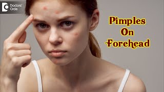 Pimples On Your Forehead? Causes & how to get rid of it? - Dr. Urmila Nischal  | Doctors