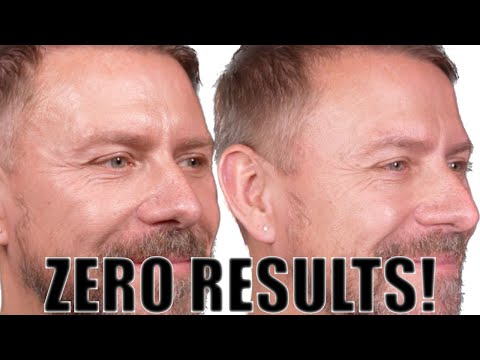 THE WORLDS MOST EXPENSIVE SKINCARE! 30 DAYS LATER!  ZERO RESULTS!