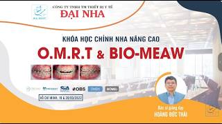 Xây dựng đường hướng dẫn dây cung #1. Giảng dạy Dr Thái với 26 năm kinh nghiệm chỉnh nha #niengrang