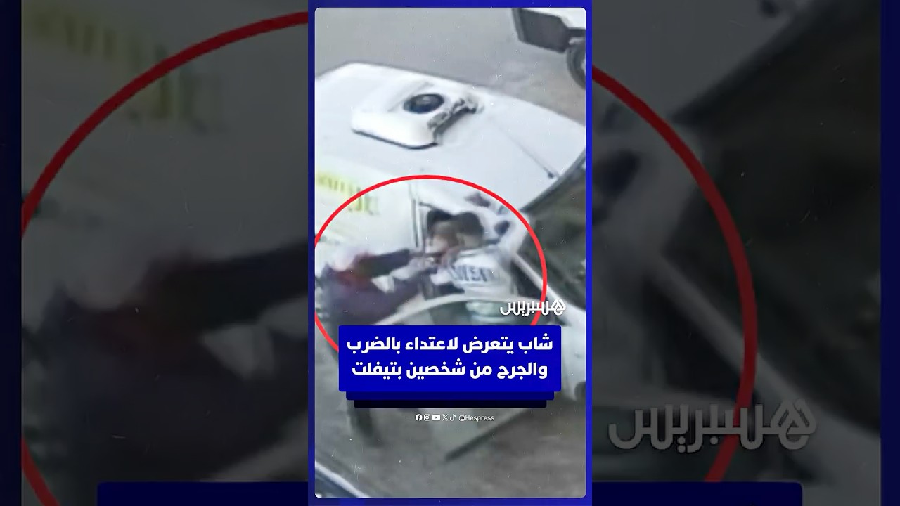 شاب يتعرض لاعتداء بالضرب والجرح من شخصين بتيفلت thumbnail