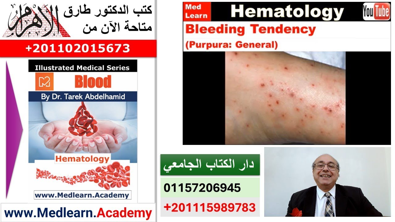 Purpura (General)   #cme #internal_medicine #medical #medicalstudent  #usmle #محاضرات_باطنة
