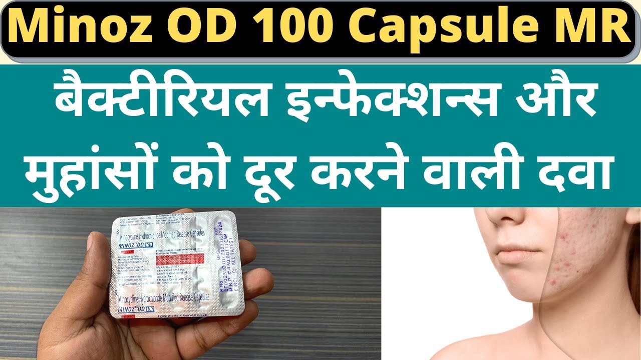 Minoz OD 100 Capsule Uses, Benefits & Side effects | To Treat Bacterial Infections & Severe Acne