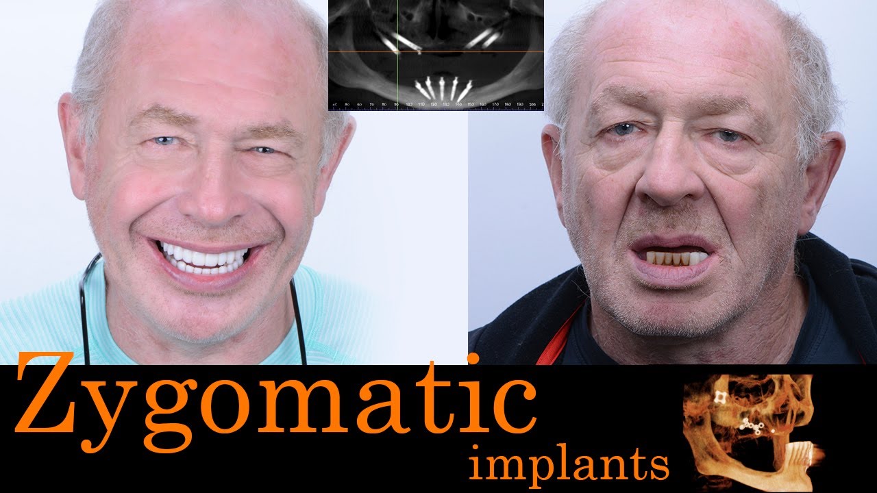 Patient Testimonial 3