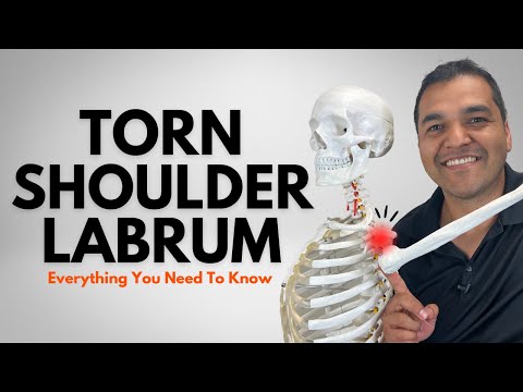 Torn Shoulder Labrum: Everything You Need To Know [Diagnosis & Treatment]