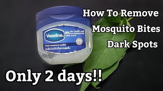 Only 2 days!! How To Remove Dark Spots, Mosquito Bites, Scar, Hyperpigmentation On Legs Fast