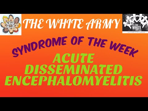 #Syndrome of the week | ACUTE DISSEMINATED ENCEPHALOMYELITIS | THE WHITE ARMY