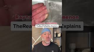 Do This When Your Fingertips Go Numb 🥶 #shorts