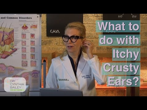 Got Itchy, Crusty Ears? (Yuck!) - Dermatologist's Tips [2019]