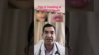 Pain & Cracking at Corner of Mouth