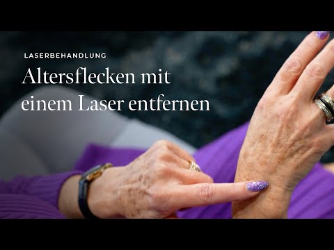 Altersflecken mit einem Laser entfernen | skinmed - Dermatologie in Lenzburg, Aargau