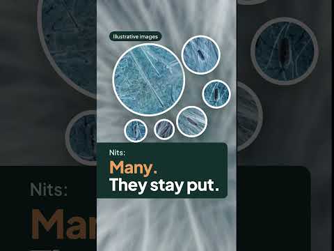 Lice Detector: Lice & Nits video thumbnail