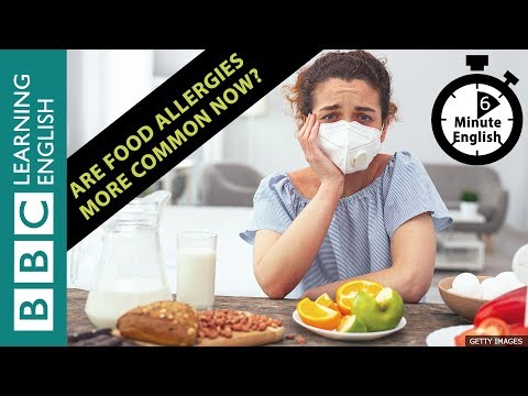 食物アレルギーは今、より一般的になっていますか?6分間の英語 (Are food allergies more common now? 6 Minute English)