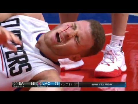 Lamarcus Aldridge Gives Blake Griffin A Bloody Eye! - (Spurs vs Clippers) - February 24, 2017