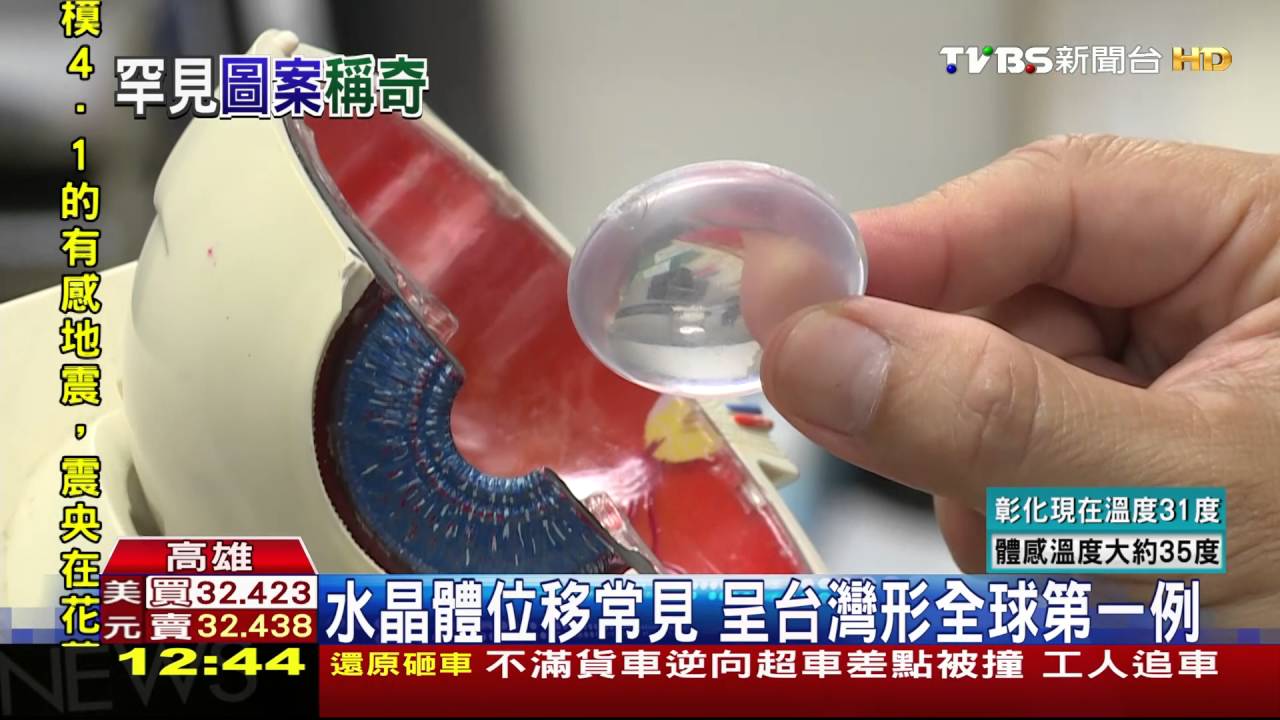 與車擦撞看不清　瞳孔竟出現台灣形狀