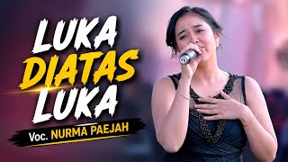 Download lagu LUKA DIATAS LUKA - NURMA PAEJAH || OM ADELLA LIVE KEMEJING BEKASI mp3 Download lagu LUKA DIATAS LUKA - NURMA PAEJAH || OM ADELLA LIVE KEMEJING BEKASI mp3