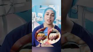 Download lagu Gum Infection #dentalcare #gumproblems #gumrecession #gumbleeding #gums #dentaltips #dentalcavity mp3 Download lagu Gum Infection #dentalcare #gumproblems #gumrecession #gumbleeding #gums #dentaltips #dentalcavity mp3