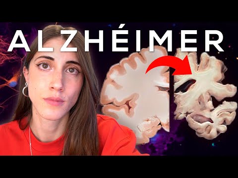 ALZHÉIMER: TODO lo que debes SABER