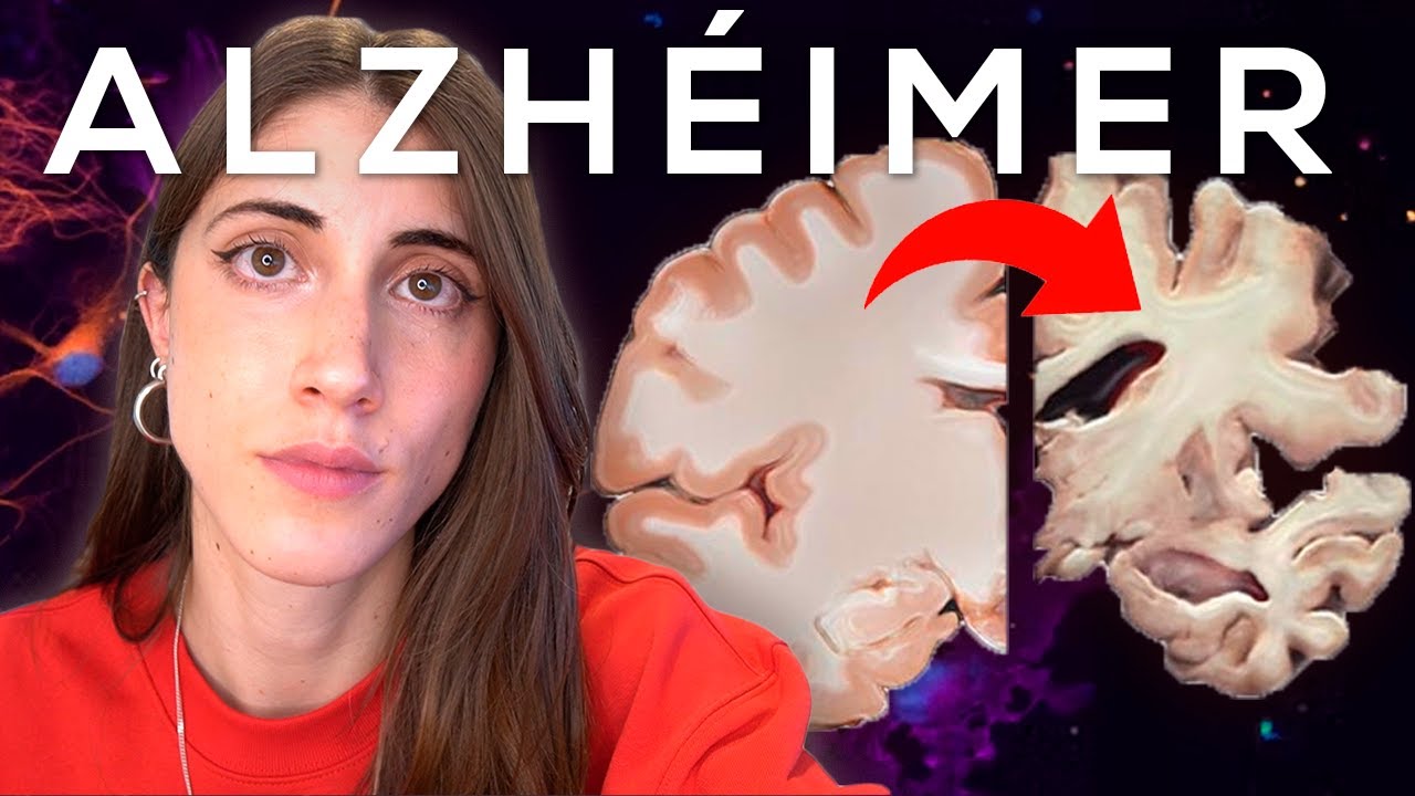ALZHÉIMER: TODO lo que debes SABER