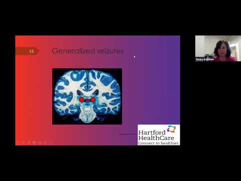 Understanding Anti-Epileptic Drugs