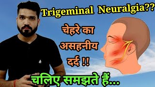 Trigeminal Neuralgia | Severe facial pain , Causes, Trigger points, Treatment ??