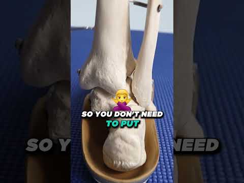 What not to do with plantar fasciitis What is plantar fasciitis