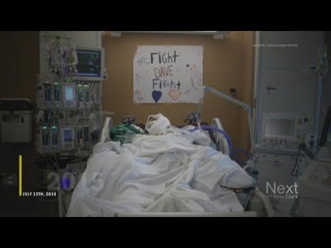 The path to recovery for a man with burns on 90 percent of his body