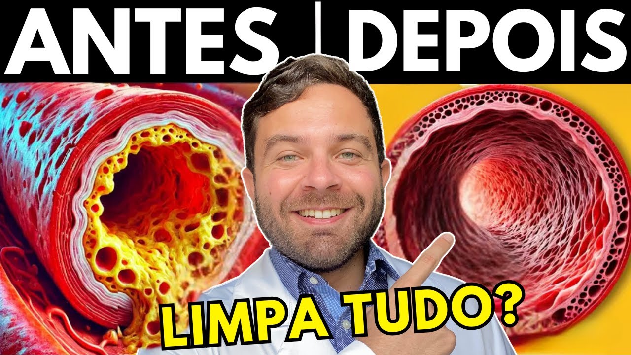 CLEAN Clogged Arteries WITHOUT MEDICATION and FAST!