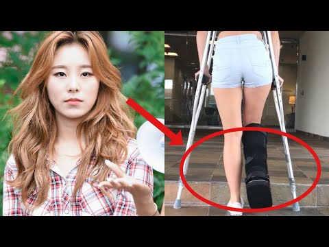 MAMAMOO Wheein Twists Her Ankle But Still Goes To Vietnam To See Fans