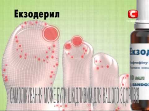 Treat kuko halamang-singaw boric acid Antifungal gamot para sa kuko halamang-singaw paa