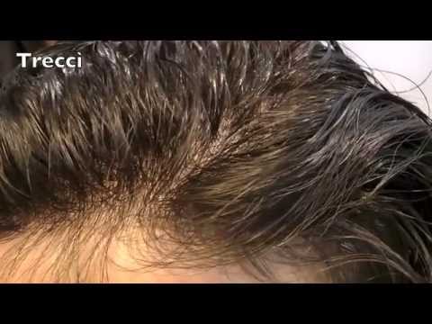 Come trattare vermi al bambino di 6 anni Video per bambini su vermi