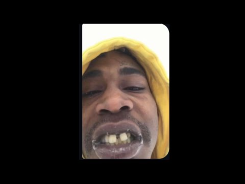 187KD & MudBaby Ru - Art Of War (Official Video) (Ytb Fatt Diss)