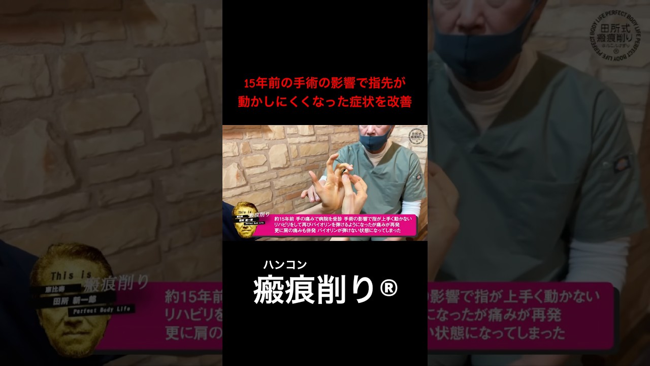 【手術の後遺症】指先が動かしにくくなってしまった症状を改善#肩こり #腰痛 #瘢痕削り