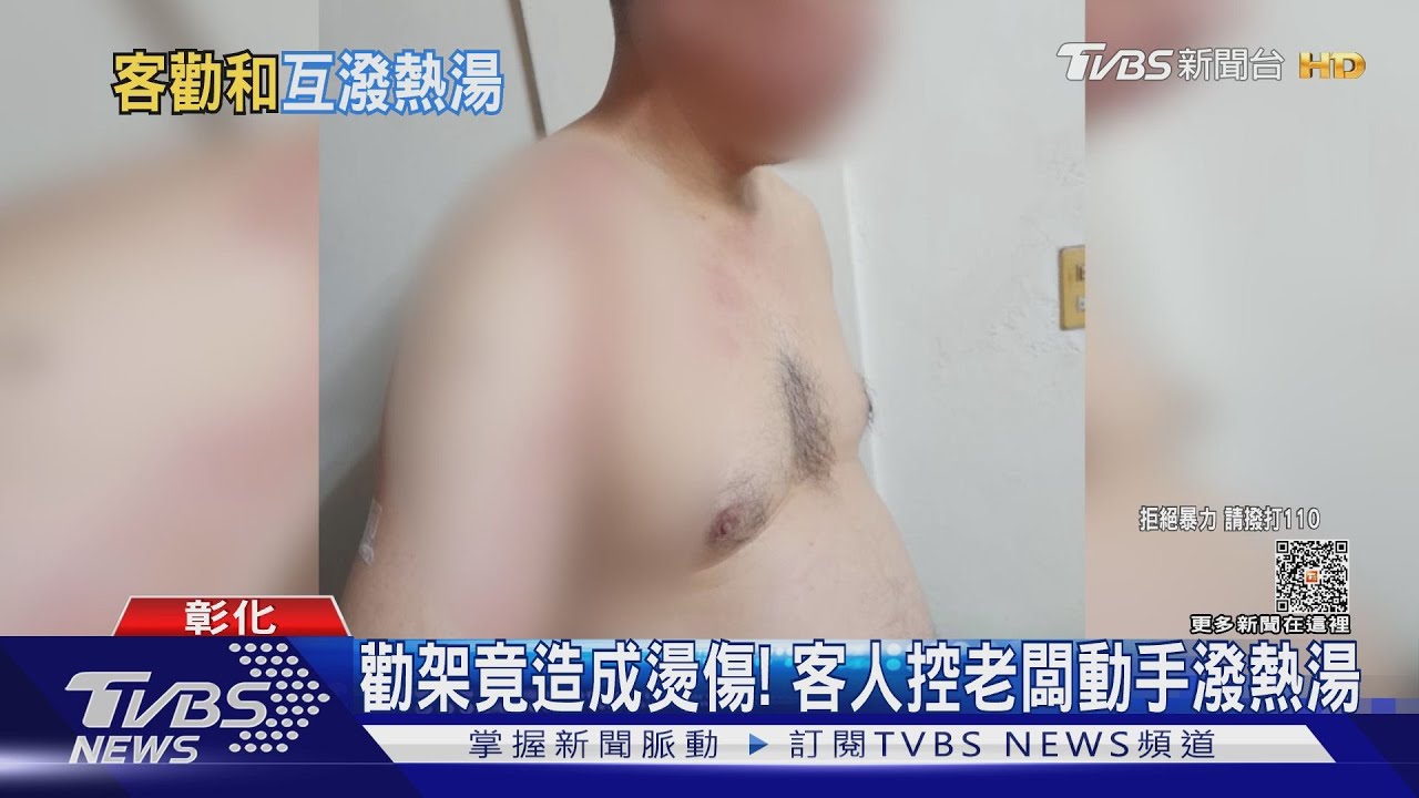 勸架竟造成燙傷! 客人控老闆動手潑熱湯