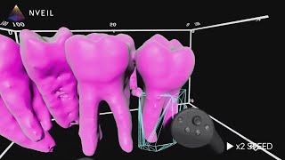 Visualizing dental CT Scan and mesh reconstruction