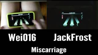 (Co-Op) The Black Dahlia Murder - Miscarriage