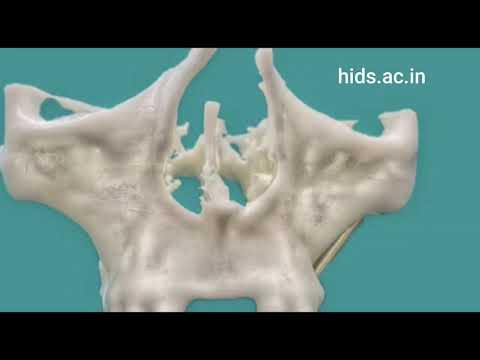 Himachal Institute of Dental Sciences Sirmaur General video thumbnail 6