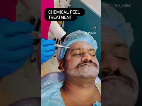 Chemical peel treatment | Dr. Dipali Dambal